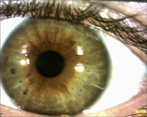 iris_1