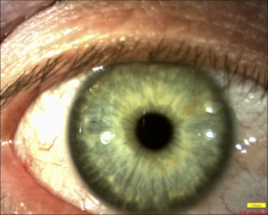 iris_2