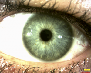 iris_3